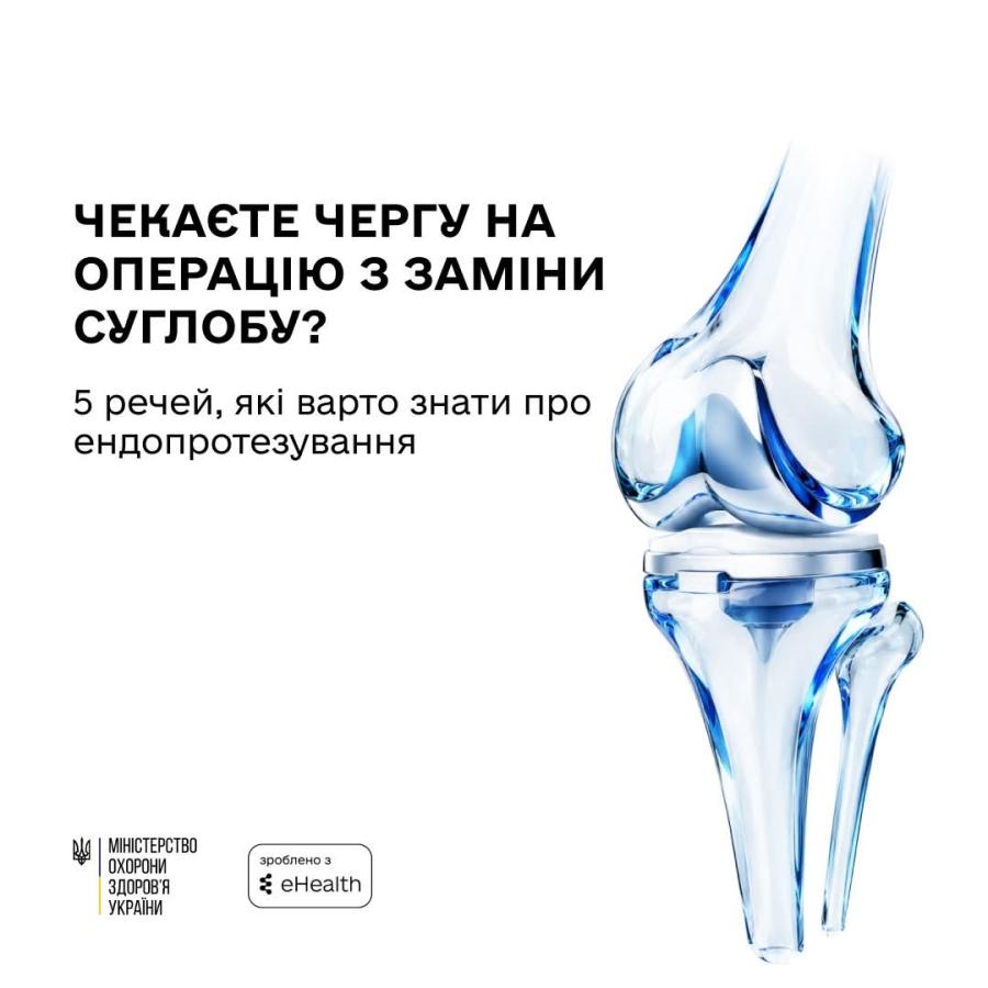 Інформаційний банер Міністерства охорони здоров'я України із зображенням штучного колінного суглоба та текстом: «Чекаєте чергу на операцію з заміни суглобу? 5 речей, які варто знати про ендопротезування».