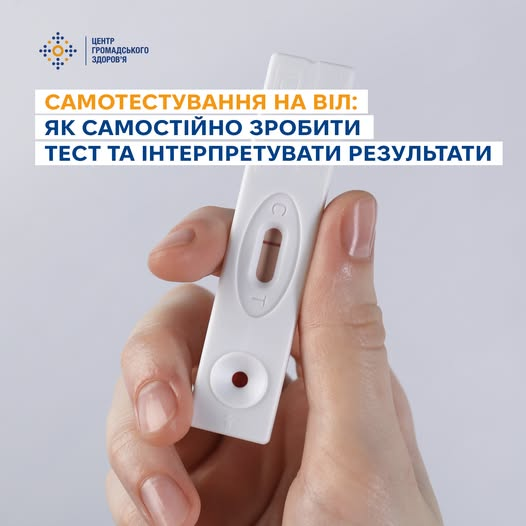 Рання діагностика ВІЛ-інфекції та вчасний початок лікування дозволяють зберегти здоров’я
