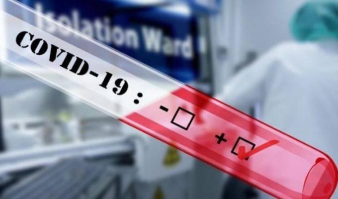 Лабораторно підтверджено 19 нових випадків COVID-19 в області 