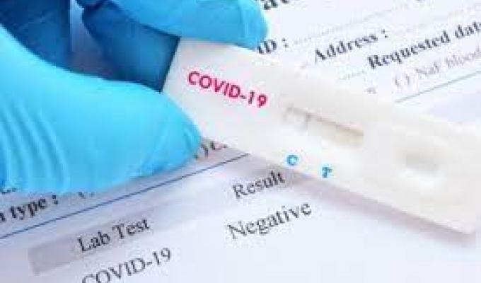 Коли варто робити тест на COVID-19? Коли варто робити тест на COVID-19?