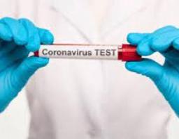 Скільки має тривати самоізоляція та коли робити тест на COVID-19: головне із брифінгу Ігоря Кузіна